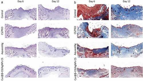 Figure 7. Effects of CS/Cur@β-CD/AgNPs nanofibrous on wound closure and re-epithelialization. (a, b) H&E and MT stain images were presented at day 6 and day 12; Scale bars represent 200 μm.