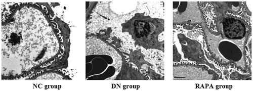 Figure 1. The podocyte pathology changed in the three groups under the electron microscope.