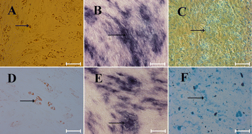 Figure 5. The differentiation ability of rbMSCs grown in FBS-containing (A–C) and serum-free (D–F) media. (A, D) Adipocytic differentiation was detected by Oil-red-O staining (red, arrow); (B, E) osteogenic differentiation was detected by alkaline phosphatase staining (purple, arrow); (C, F) chondrogenic differentiation was detected by alcian blue staining (blue, arrow). Scale bars: 200 µm.