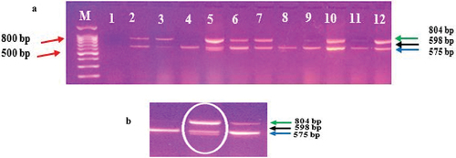 Figure 3. Multiplex bands of specific 16S RNA gene regions in orange complex pathogens for CP group.