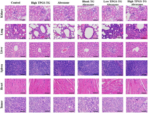 Figure 8. TPGS-TG histology in different tissue. Hematoxylin & Eosin stained tissue images (tumor, heart, liver, spleen, lung, and kidney) in different MCF-7 tumor-bearing nude mice groups. Bars represent 200 µm.