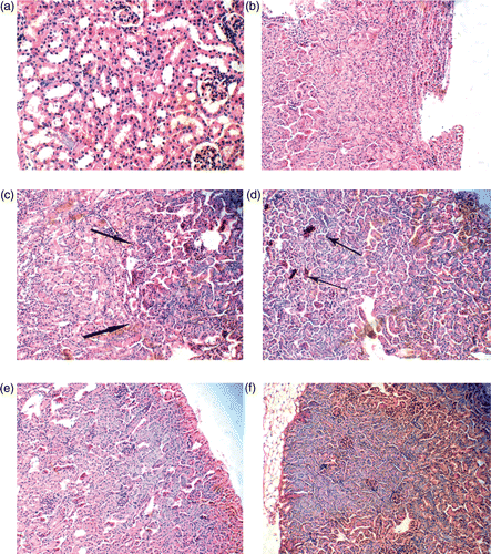 Figure 3. Histopathology of the nephric tissue in female mice after intraperitoneal injection with various doses of nano-anatase TiO2 suspensions for consecutive 14 days. (a) control group (400×): renal glomerulus is complete and renal tubule is normal; (b) 5 mg/kg BW nano-anatase TiO2 group (100×): without abnormal pathology changes; (c) 50 mg/kg nano-anatase TiO2 group (200×): arrows indicate focal basophilia; (d) 100 mg/kg BW nano-anatase TiO2 group (200×): arrows indicate focal congestion; (e) 150 mg/kg BW nano-anatase TiO2 group (200×): diffuse basophilic degeneration and (f) 150 mg/kg BW bulk TiO2 group (100×): obvious congestion, basophilic degeneration.