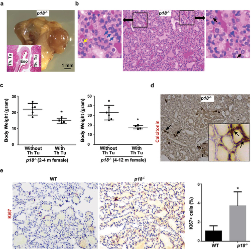 Figure 1. Loss of p18 stimulates follicular cell proliferation and induces bilateral papillary thyroid tumors. (a) Representative gross appearance and HE staining (inset) of the thyroid tumors from a 9-month-old p18−/− female mouse. Note the thyroid tumors in both sides of the esophagus (Eso.), Th., Tu., thyroid tumor. (b) Representative HE staining of p18−/− thyroid tumors. Note typical pathological PTC features including tumor cells containing enlarged, overlapping nuclei (blue arrows), cells with Orphan Annie nuclei (black arrows), and cells with nuclear grooves and nuclear membrane irregularities (yellow arrows). (c) Body weight analysis of p18−/− mice with or without thyroid tumors. Data represent the mean ± SD of five mice in 2–4 month females without thyroid tumor group, four mice in 2–4 month females with thyroid tumor group, six mice in 4–12 month females without thyroid tumor group, and four mice in 4–12 month females with thyroid tumor group. * p < 0.05 between the group without thyroid tumor and the group with thyroid tumor. (d) IHC analysis of thyroid tumors developed in p18−/− mice. Calcitonin-positive cells are indicated by arrows. Inset shows the representative IHC analysis of tumor-free thyroid. Note, the majority of tumor cells are negative for calcitonin, other than a few sporadically located calcitonin-positive cells. (e) IHC analysis of tumor-free thyroids from WT and p18−/− mice at the age of 2–4 months of age. The percentages of Ki67-positive cells were calculated from cells situated in clear duct/gland structures. Results represent the mean ± SD of three animals per group.