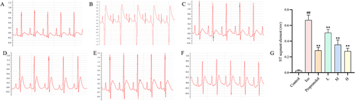 Figure 3 CRC-CDs pretreatment improves cardiac function and reduces ECG ST in rats. (A) Control group. (B) Iso group. (C) Propranolol group. (D) Low-dose CRC-CDs group. (E) Medium-dose CRC-CDs group. (F) High-dose CRC-CDs group. (G) Changes in the ST segment of the ECG in each group of rats. Date are represented as means ± SD (n=8). ##P < 0.01 compared with the control group, **P < 0.01compared with the Iso group.