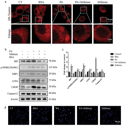 Figure 1. Silibinin alleviates ER stress and apoptosis of GLUTag cells induced by PA. (a) GLUTag cells were stained with ER-Tracker Red and visualized by confocal microscopy. (b, c) Expression levels of BiP, p-PERK (Thr981), XBP1, ATF6, CHOP and Caspase12 were evaluated by western blotting. (d) Apoptosis was detected by Hoechst 33258 staining. The mean ± S.E.M is shown. *P < .05 versus control group; #P < .05 versus PA group.