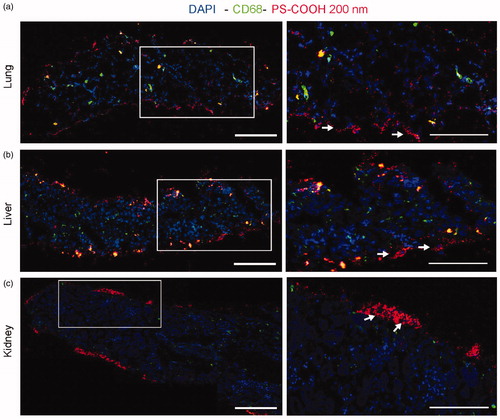 Figure 4. Confocal fluorescence images of murine lung (a), liver (b), and kidney (c) slices exposed to 200 nm PS-COOH nanoparticles. Cross-sections were acquired by confocal fluorescence microscopy after exposure for 48 h to 10 μg/mL 200 nm orange PS-COOH nanoparticles in medium supplemented with 5% FBS. The indicated areas are shown at increased magnification to the right. For a, b and c, scale bars, from left: 200 and 100 μm. Blue: DAPI-stained nuclei. Red: nanoparticles. Green: CD68-labeled macrophages (For interpretation of the references to colours in this legend, please refer to the web version of this article.). In the lungs (a) and the liver (b), uptake in the macrophages was observed, but also in other cells (as indicated by the arrows). In the kidneys (c), lower nanoparticle uptake and less penetration into the tissue were observed, as well as strong nanoparticle adsorption on the edge of the slices, as indicated by the arrows.