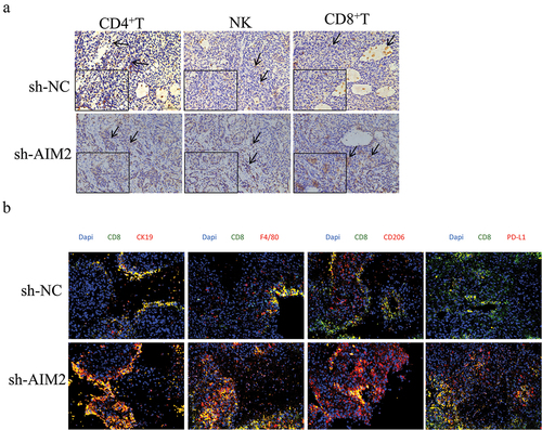 Figure 4. AIM2 represses the immune infiltration of CD8+T cells.