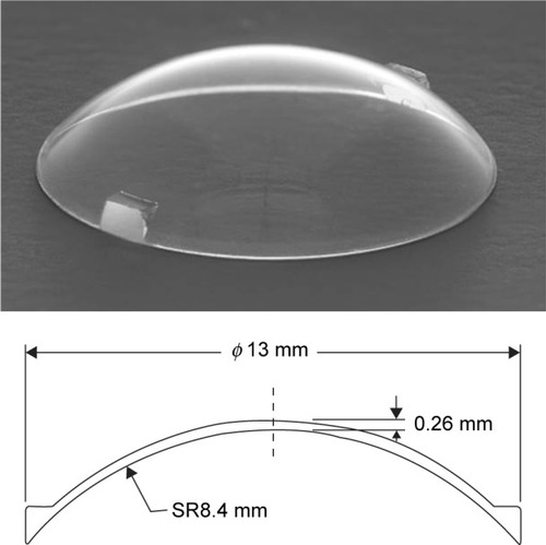 Figure 1 External view (top) and the schematic diagram of the cross-sectional view of the contact lens (bottom).