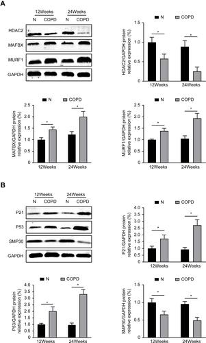 Figure 2 Atrophy and senescence-related protein expression in mice. (A) The atrophy-associated markers protein expression level of MURF1, MAFbx, HDAC2 after 12 and 24 weeks. (B) The senescence markers protein expression level of P53, P21, SMP30 after 12 and 24 weeks. Values are expressed as means±SD. Experiments were repeated 3 times with similar results. *p<0.05 vs control group (N).