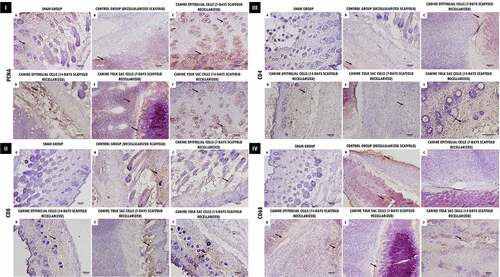 Figure 6. Immunohistochemical analysis of decellularized and recellularized tracheal scaffolds (EpC/YS) implanted in the subcutaneous tissue of balb-C nude mice. I. Proliferating cell nuclear antigen (PCNA). Observe proliferative activity in areas adjacent to the implant (arrows), demonstrating a positive interaction of scaffolds in the biocompatibility test. II. CD8. In (a, c and d) Note discrete positive marking for the presence of lymphocytes in areas adjacent to the implant (arrows), In (b, e and f) more intense marking for CD8 T cells, demonstrating an active role in the healing process of the implanted scaffolds in the biocompatibility test. III. CD4. Observe discrete positive marking for the presence of lymphocytes in areas adjacent to the implant (arrows), demonstrating an active role in the healing process of the implanted scaffolds in the biocompatibility test. IV. CD68. Observe more intense positive staining in control tissues (b), and in scaffolds recellularized at 14 days (d, f), respectively, demonstrating the presence of macrophages in areas adjacent to the implant (arrows), proving to be crucial to promote a remodeling response constructive use of the ECM. Scale Bar: (A-F: 100 µm, 10x).