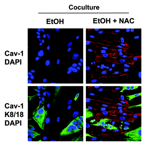 Figure 11. Anti-oxidant treatment prevents the ethanol-induced loss of Cav-1 in cancer-associated fibroblasts. MCF7 cells were co-cultured with fibroblasts for 2 d, and treated with 100 mM EtOH for an additional 72 h. Then, 10 mM NAC or vehicle was added for 24 h. The cells were fixed and immunostained with antibody probes against Cav-1 (red, upper panels) and keratin-8/18 (K8/18, green, lower panels). Nuclei were counterstained with DAPI (blue). K8/18 staining is specific for MCF7 cells and Cav-1 is specific for fibroblasts, since MCF7 cells lack Cav-1 expression. Note that treatment with the antioxidant NAC prevents the downregulation of Cav-1 in the fibroblast compartment, as compared with co-cultured fibroblasts in the absence of NAC. Original magnification, 40x.