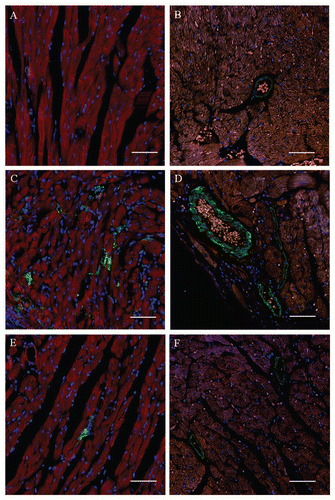 Figure 4 Expression of galectin-3 and syndecan-4 in hearts of chronic chagasic mice treated with bone marrow cells. Heart sections of normal mice (A and B), of mice injected with saline (C and D) or with BMC (E and F). Sections were stained (red) with anti-galectin-3 (A, C and E) or anti-syndecan-4 (B, D and F). Nuclei (blue) were stained with DAPI. Scale bars: 50 µm (original magnification ×40).