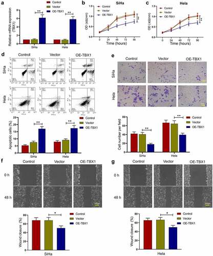 Figure 2. TBX1 inhibited CC cell growth and metastasis. (a) Relative mRNA expression of TBX1 was detected by qRT-PCR. (b, c) Cell viability was determined by CCK-8 assay. (d) Flow cytometry was used to detect the apoptosis rate of CC cells. (e) Cell invasion was detected by transwell assay. Scale bars: 100 μm. (f, g) Wound-healing assay was performed to determine cell migration ability. Scale bars: 200 μm. * p < 0.05, ** p < 0.01