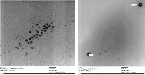 Figure 3. TEM images of the optimized EPL-loaded NLCs system.
