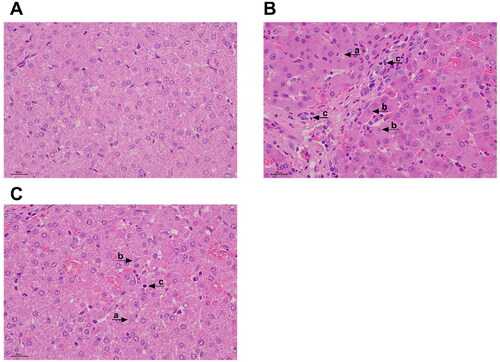 Figure 1. Effects of tryptophan on liver Morphology in piglets after 4h lipopolysaccharide (LPS) challenge in piglets. (A) CONTR group, piglets were fed basal diet and injected with normal saline. Normal liver histology. (B) LPS group, piglets were fed a basal diet and injected intraperitoneally with LPS. Piglet liver showed significant pathological changes, including (a) heptatocyte caryolysis, (b) karyopycnosis, (c) inflammatory cell infiltration, hyperemia in hepatic sinusoids and hepatic cell cords arrangement in disorder were found. (C) Trp + LPS group, piglets were fed a basal diet supplemented with 0.2% tryptophan and injected intraperitoneally with LPS. n = 6 (1 pig/pen). original magnifications 400×. scale bars = 22.4 µm.