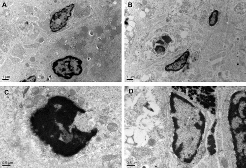 Figure 8 Electron micrograph of uterus and ovarian. Well-preserved morphology and intact nucleus, microvillus structure and abundant villi of the uterus are observed in the saline group (A) and (PEI-SA)HA/PC group (B). The normal morphology of nucleus can be seen in saline group (C) and (PEI-SA)HA/PC group (D), apoptotic cells containing nuclear fragments were not found. There is no significant difference in ultra-structure between the control group and the (PEI-SA)HA/PC group.