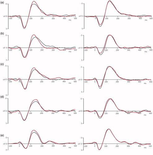 Figure 6. Auditory tetanic stimulation induced potentiation on the N1. In the Tetanus condition (left column), the post-tetanus amplitude of the N1 was higher than that of pre-tetanus, whereas there was no such increase in the Control condition (right column). (a) 1 kHz PT, (b) 1 kHz NBN, (c) 6 kHz PT, (d) 6 kHz NBN, and (e) WN. The black lines are pre-tetanus waves, and the red lines are post-tetanus waves.