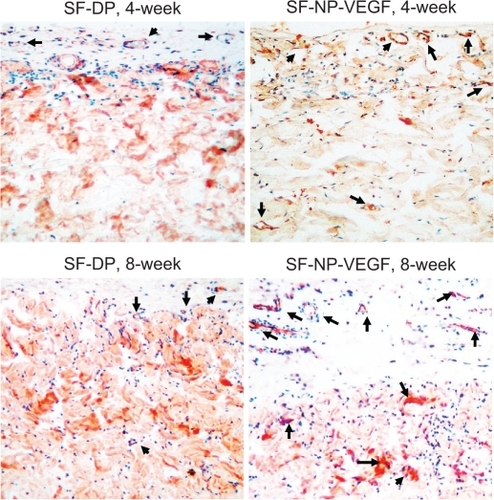 Figure 6 CD31staining of implant sections. The endothelial cells were stained by anti-CD31 antibody, original magnification × 200.Note: The arrows indicate the positive staining.Abbreviations: CD31, cluster of differentiation molecule 31; DP, decellularized scaffolds; NP, nanoparticle; SF, scaffolds; VEGF, vascular endothelial growth factor