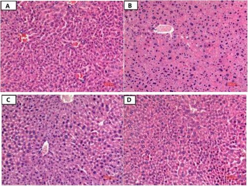 Figure 4. The liver morphological structure of mice in each group. (a) NC, normal control group; (b) MG, model group; (c) L-LP, low dose of loach meat paste; (d) H-LP, high dose of loach paste.