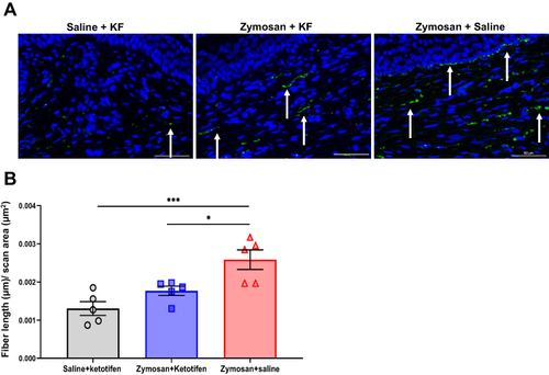 Figure 12 Long-term effects of mast cells stabilizer KF on vulvar hyperinnervation. (A) Nerve fibers [as detected by immunoreactivity (IR) for the pan-axonal marker protein gene product 9.5 (PGP 9.5; green)] merged with dapi stain (blue). Scale bar: 50 µm. (B) Fiber length (µm) per unit area (µm2) in the saline- ketotifen, the zymosan-Ketotifen, and the zymosan-saline group (n=5 per group). Mean ± SEM. *P<0.05, ***P<0.001.