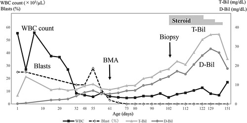 Figure 1 . Clinical course of the patient and changes in bilirubin, white blood cell count, and blast ratio in the peripheral blood. WBC: white blood cell; BMA: bone marrow aspiration; T-Bil: total bilirubin; D-Bil: direct bilirubin.
