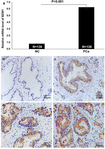 Figure 1. The expression levels of BZW1 were detected in PCa. (a) qRT-PCR revealed that the mRNA levels of BZW1 were significantly higher in PCa compared with those in NC. (NC: non-cancerous prostate tissues). (b) BZW1 low expression in non-cancerous prostate tissues by IHC (score = 0). (c) BZW1 low expression in PCa by IHC (score = 2). (d) BZW1 high expression in PCa by IHC (score = 4). (e) BZW1 high expression in PCa by IHC (score = 6)