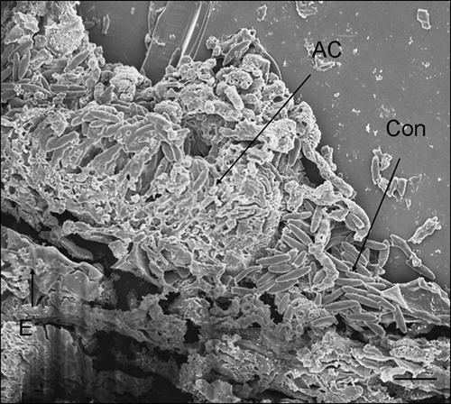 Figure 8. Scanning electron micrograph of Discula destructiva acervulus (AC) fully developed on Cornus florida ‘Cloud 9’ leaf at 24 DAI. Note the crushed epidermal cell layer (E). Con, Conidia. Bar = 10 μm.