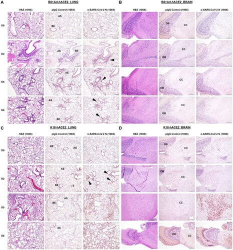 Figure 4. Comparison of histology and immunohistochemistry on lung and brain tissue from B6 AdhACE2 or K18-hACE2 animal models following SARS-CoV-2 challenge. (A) Paraffin lung sections (5μm) from B6 mice administered intranasally (i.n) with 2.5×108 PFU Ad-hACE2 and subsequently challenged with 1×104 PFU of SARS-CoV-2 were stained by H&E, or for SARS-CoV-2 N protein (n=3 per group, per timepoint). Lungs were harvested on D0, D2, D5 and D6 post-challenge. Regions of the lung anatomy are indicated on images for negative control polyclonal IgG (pIgG) antibody sections: AS = alveolar septa or BE = bronchiolar epithelium. Black arrow indicates regions of specific dark brown/red anti-SARS-CoV-2 N staining for less obvious regions of positive labelling. (B) Paraffin brain sections (5μm) from B6 Ad-hACE2, as above. Regions of brain anatomy are indicated: OB = olfactory bulb, CC = cerebral cortex. (C) H&E sections and IHC-P for SARS-CoV-2 N was also performed on lung and (D) brain tissue sections from K18-hACE2 transgenic mice at the same time-points post-challenge with SARS-CoV-2. Scale bar on all images is 200 nm, IHC-P staining is indicated by red staining for Nova Red substrate.