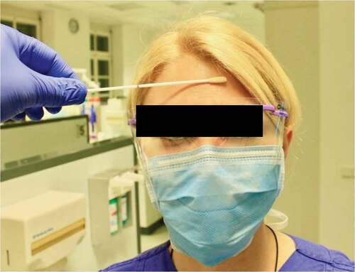 Figure 1.  Sampling using an eSwab™. The entire forehead area not covered by hair was wiped off for 5–8 s