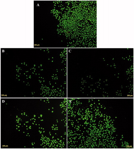 Figure 10. Fluorescence microscopy images of HaCaT cells after 24 h incubation with the extraction medium of 3D-porous scaffolds. (A) CHT/SS, (B) CHT/SS/250ZnO, (C) CHT/SS/250ZnO, (D) CHT/SS/0.01LA, and (E) CHT/SS/0.02LA. Scale bars are100 μm.