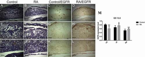 Figure 7. Photomicrographs of the transverse sections of the mice utero-placental units on gestation day (GD) 13.5 from control (a, e, i, c, g, k) and RA treated (b, f, j, d, h, l) groups. (a, e, i) Histology of the developed utero-placental unit from the control group showing, reduction of the thickness of both decidual basalis (DB) and junctional zone (JZ), while the thickness of the labyrinth zone (LB) is increased comparing to the previous stage (GD10.5). (e) a magnified part of the decidual basalis and junctional zone (JZ). (i) a magnified part of labyrinth zone. (b, f, and j) Showing effect of RA treatment on the utero-placental development, note small size of the placenta with inhibition of the development of the labyrinth zones (Hx & E staining). (c, g, and k) illustrate the immunohistochemical localization of EGFR of the utero-placental unit from control group, note weak expression of EGFR in decidual basalis and junctional zone, while in labyrinth zone the expression is strong. (d, h, l) showing the effect of RA on EGFR, the expression level of EGFR is moderate in decidual basalis (DB), junctional zone (JZ), and labyrinth zone (LB). (M) Optical density of EGFR-positive areas in decidual basalis (DB), junctional zone (JZ) and labyrinth zone (LB). Density is expressed as the number of positive areas. *P < 0.05, **P < 0.01 compared with the control group. Scale bar (a–d): 100 µm, (e–l): 50 µm.