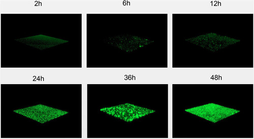 Figure 4 Confocal laser scanning microscopy images of S. maltophilia strain (ATCC17666) biofilms after 2, 6, 12, 24, 36, and 48 hours. Biofilm matrix components were stained with 0.01% AO. CLSM analysis showed bacterial biofilm beginning to form after 2 h incubation. The biological membrane structure is close, and the thickness increased over 12–24 h incubation. The three-dimensional space network structure gradually formed between 36–48 h incubation.