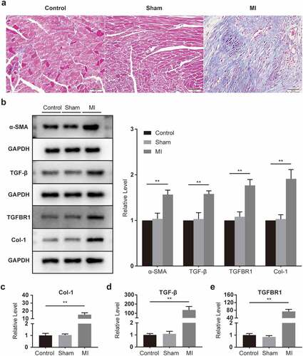 Figure 2. Fibrosis activation in infarcted myocardium. (a) Representative images of mouse heart sections (10 × 40 magnification of 400×) (n = 5 per group, Bar = 50 μm). (b) α-SMA, TGF-β, TGFBR1, and Col-1 protein levels, as determined with Western blot (n = 6 per group). (c-e) Col-1, TGF-β, and TGFBR1 mRNA levels, as determined with rt-PCR (n = 6 per group).