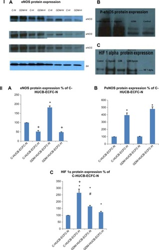 Figure 4 (I) Representative gel pictures of (I) (A) eNOS, (B) p-eNOS, and (C) HIF 1α protein expressions; (II) represents quantitative assessments of eNOS (A), p-eNOS (B) and HIF1-alpha (C). Signal intensities were normalized with concomitant β-actin (n=4 C and n=4 GDM). HUCB ECFCs were exposed to 7 days of hypoxic condition. (IIA) eNOS. *GDM HUCB ECFC-N significantly different from C-HUCB ECFC-N, C-HUCB ECFC-H GDM HUCB ECFC-H; +C-HUCB ECFC-H and GDM-HUCB ECFC-H are significantly different from C-HUCB ECFC-N and GDM-HUCB ECFC-N (P<0.01); (IIB) p-eNOS; *C-HUCB ECFCH and GDM-HUCB ECFC-H are different from C-HUCB ECFC-N and GDM-HUCB ECFC-N (P<0.001); (IIC)-HIF 1α. *C-HUCB ECFC-H, GDM-HUCB ECFC-N, and GDM-HUCB ECFC-H are different from C-HUCB ECFC-N (P<0.001). +C-HUCB ECFC-H is different from CHUCB ECFC-N, GDM-HUCB ECFC-N, and GDM-HUCB ECFC-H (P<0.001). #GDM-HUCB ECFC-N is different from C-HUCB ECFC-N and GDM-HUCB ECFC-H (P<0.05).