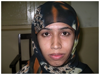 Figure 4 A 16-year-old girl underwent left monocular strabismus surgery (15th postoperative day).