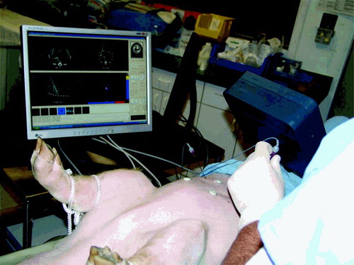 Figure 7. Swine animal study in the CT suite completed under an approved protocol showing the Navigator user interface. [Color version available online.]