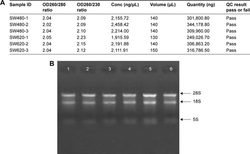 Figure 1 RNA quality control in total six cell samples. (A) RNA quantification and quality assurance by NanoDrop ND-1000. (B) RNA integrity and gDNA contamination test by denaturing agarose gel electrophoresis. Lanes 1, 2, 3, 4, 5, and 6: total RNA of samples SW480-1, SW480-2, SW480-3, SW620-1, SW620-2, and SW620-3. Table 1 Pearson correlation coefficient to measure repeatability between six total RNAs of samples SW480-1, SW480-2, SW480-3, SW620-1, SW620-2, and SW620-3Download CSVDisplay Table