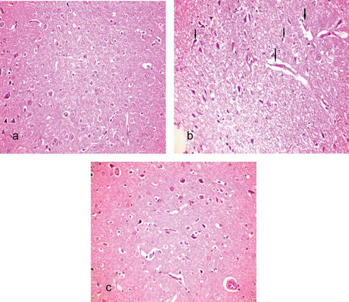 Figure 1. Light microscopy of brain tissues in different groups [hematoxylin and eosin (H&E), magnification 200×]. (a) Normal cerebral cortex (control group). (b) Pyknosis, degeneration at the capillary vessels, perineural and perivascular edema (sepsis group). (c) perineural and perivascular mild/moderate edema (treatment group).