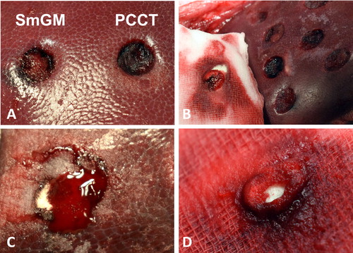FIGURE 7. (A) Left: liver punch biopsy lesion treated with SmGM. Right: Liver punch biopsy lesion treated with PCCT. (B) PCCT material residues sticking to the wet gauze used for approximation. (C) Residual bleeding after application of PCCT. The lesion is filled with partially white, non-saturated powder, demonstrating a limited absorption capacity for blood. (D) PCCT residues sticking to the gauze after approximation. Note the blood-soaked gauze and the dry, non-soaked core of the powder.