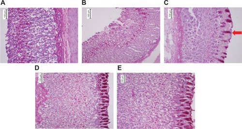 Figure 6 Histopathological staining of gastric tissues after treatment with EEAM at (C) 200 mg/kg and (D) 400 mg/kg doses, and (E) omeprazole, using PAS staining (20×). (A) and (B) are presenting the normal control and lesion control groups, respectively. PAS staining illustrated the glycogen accumulation (red arrow) in rats pretreated with EEAM and omeprazole.