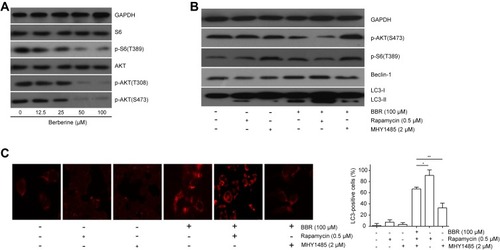 Figure 4 AKT/mTORC1 inactivation mediates BBR-induced cell autophagy. (A) EU-6 cells were treated with different concentrations of BBR (0, 12.5, 25, 50, 100 μM), Western blot was performed to detect the proteins of AKT/mTORC1 signaling. (B) EU-6 cells were treated with 100 μM BBR in the presence or absence of rapamycin or MHY1485, Western blot was conducted to determine cell autophagic markers, (C) immunofluorescence assay was performed to detect the LC3-positive cells. Data were showed as mean±SD, n=3, *p<0.05, **p<0.01.