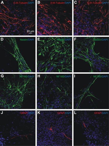 Figure 5 Immunocytochemical characterization of differentiating iPSC-NPs.Notes: First column (A, D, G and J) represents unlabeled cells, second column (B, E, H and K) represents cells labeled with CZF (15 μg Fe/mL in cultivation media for 72 hours), and third column (C, F, I and L) represents cells labeled with PLL-coated γ-Fe2O3 (15 μg Fe/mL in cultivation media for 72 hours). Cells are stained for β-III-tubulin (A–C) red, nestin (D–F), NF160 (G–I) green, GFAP (J–L) red and DAPI (blue) 2 weeks after onset of differentiation.Abbreviations: iPSC-NPs, induced pluripotent stem cell-derived neural precursors; CZF, silica-coated cobalt zinc ferrite nanoparticles; PLL-coated γ-Fe2O3, poly-l-lysine-coated iron oxide superparamagnetic nanoparticles; NF160, neurofilament 160 kDa; GFAP, glial fibrillary acidic protein; DAPI, 4′,6-diamidino-2-phenylindole, dihydrochloride.