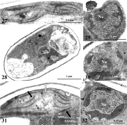 Figs. 27–32. TEM images of Koliella antarctica cells maintained in complete darkness for 30 or 40 days. Figs. 27–30. Cells cultured in dark for 30 days. Fig. 27. Detail of plastid showing single straight thylakoids, originating from bundles of membranes. Fig. 28. Cell showing autophagic phenomena at the cytoplasmic level, altered plastid (C), and strong chromatin condensation in the nucleus (N). Fig. 29. Cell with condensed chromatin in the shape of voluminous patches in the nucleus. Nu, nucleolus. Fig. 30. Dissolving nucleolus in a cell. Figs 31, 32. Cells cultured in dark for 40 days. Fig. 31. Plastid showing reduced membrane system with appressed (dark arrows) and single straight (white arrow) thylakoids; degeneration of stroma has occurred in central portion of organelle. Fig. 32. Nucleus with large patches of condensed chromatin close to the envelope, and dissolving nucleolus.