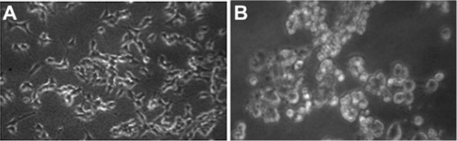 Figure 2 Morphology of human skin malignant melanoma cells A375. (A) Control, (B) 10 μg/mL of ZnONPs treated for 48 hours.Note: Magnification 200×.Abbreviation: ZnOPs, zinc oxide nanoparticles.