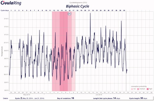 Figure 3. Normal biphasic cycle with ovulation at Day 16.