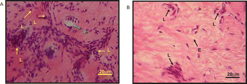 Figure 1.  Photomicrographs showing the histology of paw skin dermis with hematoxylin and eosin staining at 5 h (×40). (A) Skin treated with saline showed margination and migration of leukocytes (L) and their accumulation in the focus of injury. Infiltrations of leukocytes are part of the inflammatory processes occurring after injury. The dermis also showed inflammation with edema associated with vasodilatation of the blood vessel (V). (B) The rat treated with 300 mg/kg ACRE showed scanty or slight leukocytic (L) infiltration. Slight edema (E) can also be seen within the area of injury.