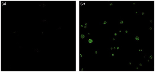 Figure 4. Fluorescence microscopy (FLM) images of Caco-2 cells after 2 h incubation with coumarin-6 solution (a) and coumarin-6-loaded ST-P123-MMs (b).