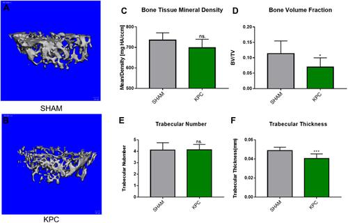 Figure 6 Pancreatic cancer decreased the femoral microstructure and bone tissue mineral density. Representative 3-D Micro-CT images of trabecular bone microarchitecture above the growth plate of the distal end of the femur in SHAM (A) and KPC (B). A volume of interest with 1.2mm height was selected for the analysis of trabecular bone micro-architecture. The BMD, bone volume fraction, trabecular thickness and trabecular number were evaluated (C–F). *P < 0.05, ***P< 0.01.