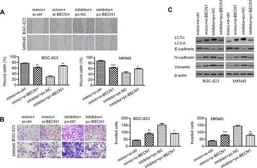 Figure 7 BECN1 interfered with migration, invasion and EMT regulated by miR-140-3p. (A) A wound healing assay was used to detect the migration of BGC-823 and MKN45 cells; scale bar = 100 μm. (B) A Transwell assay was used to detect cell invasion; scale bar = 100 μm. (C) The protein expression of Vimentin, N-cadherin, E-cadherin, and LC3 II/I was determined using Western blot analysis. *P<0.05; **P<0.01; ***P<0.001.