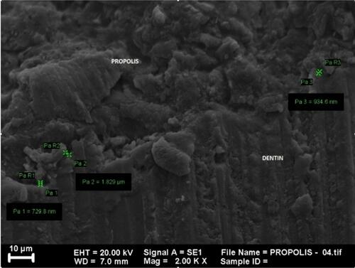 Figure 2 SEM image of group treated with propolis extract at 2000x magnification.